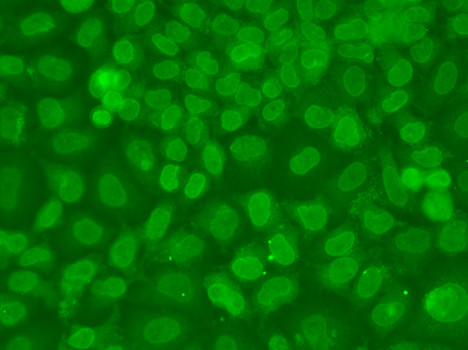 TRBP Antibody in Immunocytochemistry (ICC/IF)