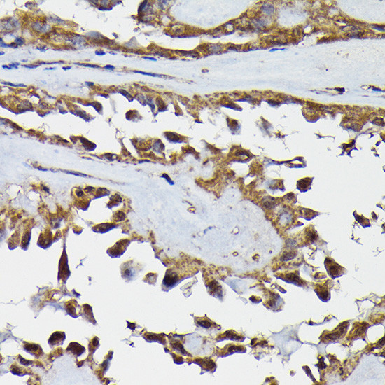 TRBP Antibody in Immunohistochemistry (Paraffin) (IHC (P))