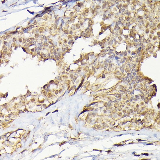 TRBP Antibody in Immunohistochemistry (Paraffin) (IHC (P))