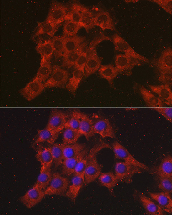 CCL3 Antibody in Immunocytochemistry (ICC/IF)