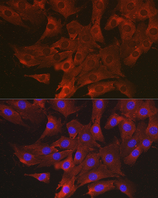 CCL3 Antibody in Immunocytochemistry (ICC/IF)