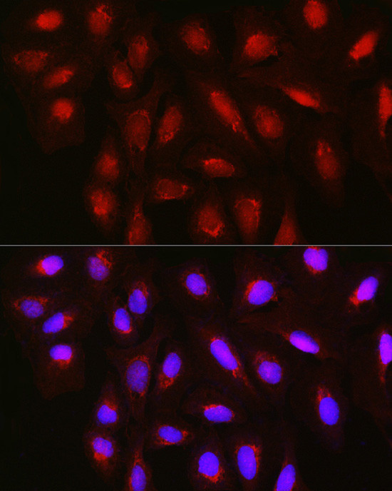 TET3 Antibody in Immunocytochemistry (ICC/IF)