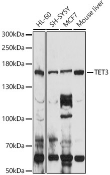 TET3 Antibody in Western Blot (WB)