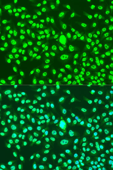 Cyclin A2 Antibody in Immunocytochemistry (ICC/IF)