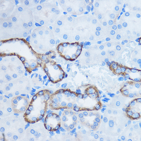 14-3-3 zeta Antibody in Immunohistochemistry (Paraffin) (IHC (P))