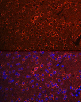 14-3-3 zeta Antibody in Immunohistochemistry (Paraffin) (IHC (P))