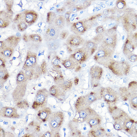 BAAT Antibody in Immunohistochemistry (Paraffin) (IHC (P))