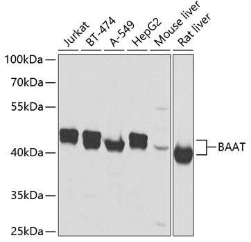 BAAT Antibody in Western Blot (WB)