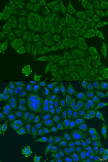 BCS1L Antibody in Immunocytochemistry (ICC/IF)