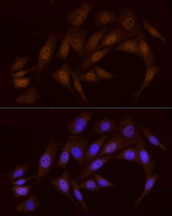 Chk1 Antibody in Immunocytochemistry (ICC/IF)