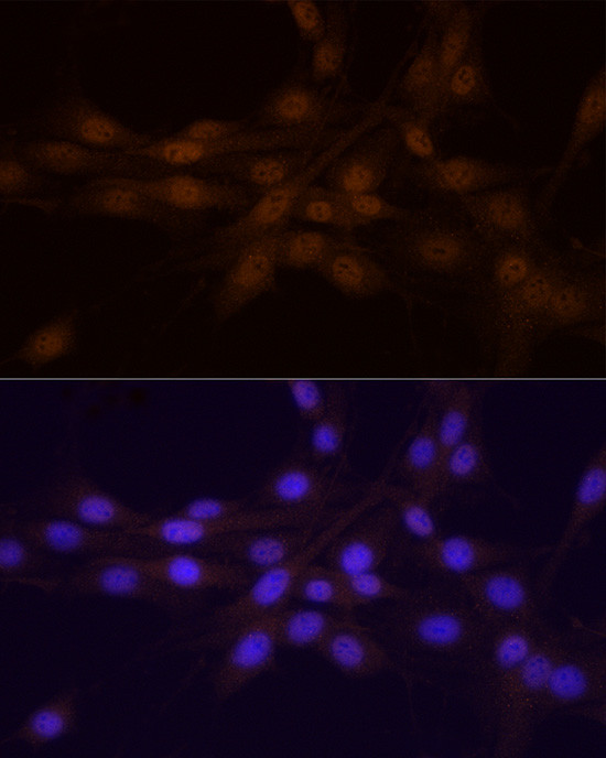 Chk1 Antibody in Immunocytochemistry (ICC/IF)