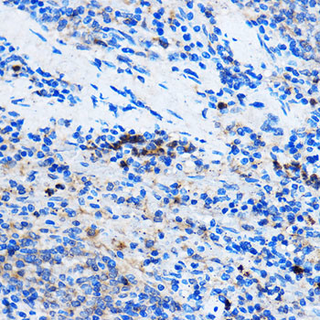 Chk1 Antibody in Immunohistochemistry (Paraffin) (IHC (P))