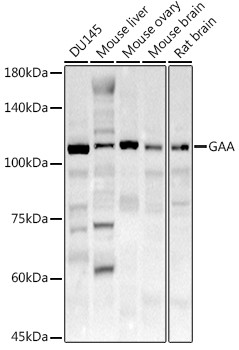 GAA Antibody in Western Blot (WB)