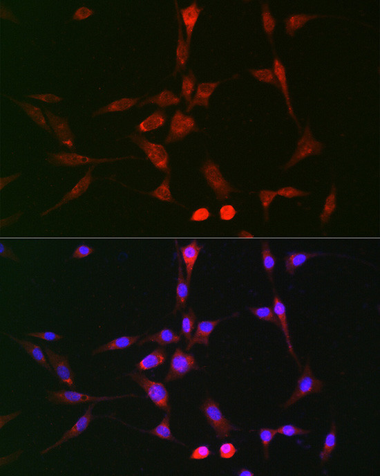 LOX Antibody in Immunocytochemistry (ICC/IF)