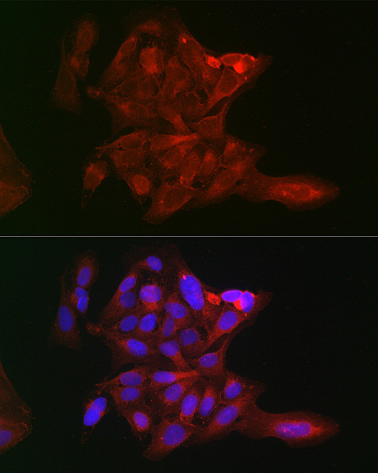 LOX Antibody in Immunocytochemistry (ICC/IF)