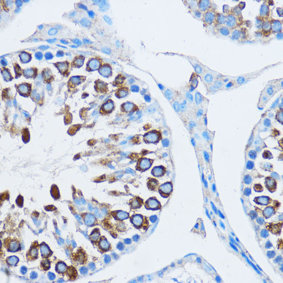 YBX1 Antibody in Immunohistochemistry (Paraffin) (IHC (P))