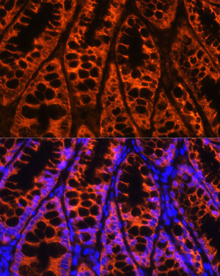 YBX1 Antibody in Immunohistochemistry (Paraffin) (IHC (P))