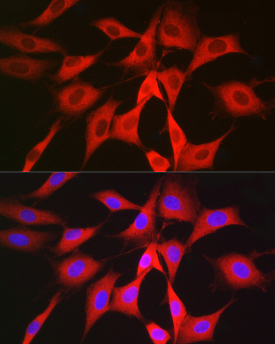 PGD Antibody in Immunocytochemistry (ICC/IF)