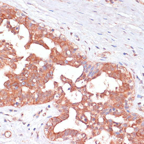 PGD Antibody in Immunohistochemistry (Paraffin) (IHC (P))