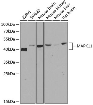 p38 MAPK beta Antibody in Western Blot (WB)