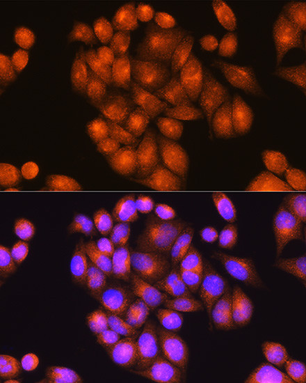 PSEN2 Antibody in Immunocytochemistry (ICC/IF)