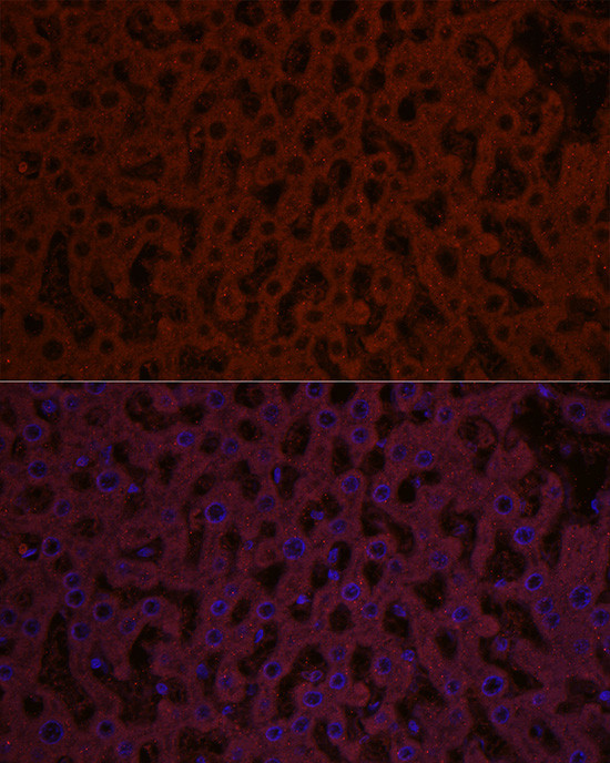 SHH Antibody in Immunocytochemistry (ICC/IF)