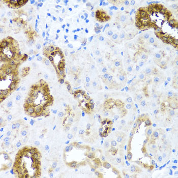 SHH Antibody in Immunohistochemistry (Paraffin) (IHC (P))