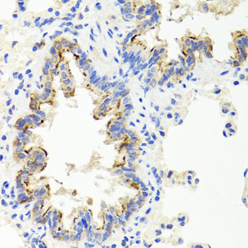 SHH Antibody in Immunohistochemistry (Paraffin) (IHC (P))