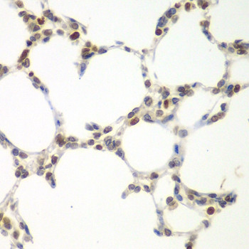 VRK1 Antibody in Immunohistochemistry (Paraffin) (IHC (P))