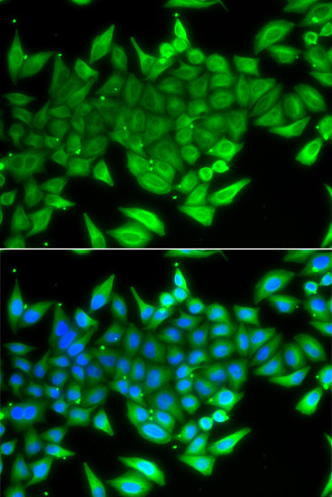 TTF2 Antibody in Immunocytochemistry (ICC/IF)