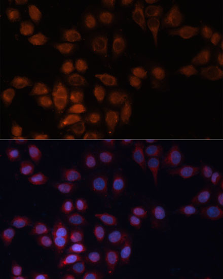 ADAM15 Antibody in Immunocytochemistry (ICC/IF)