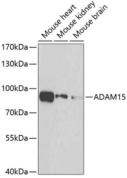 ADAM15 Antibody in Western Blot (WB)