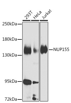 NUP155 Antibody in Western Blot (WB)