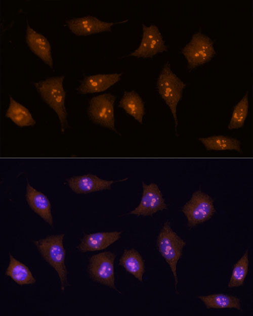 KDM5B Antibody in Immunocytochemistry (ICC/IF)