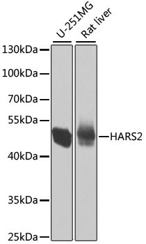 HARS2 Antibody in Western Blot (WB)