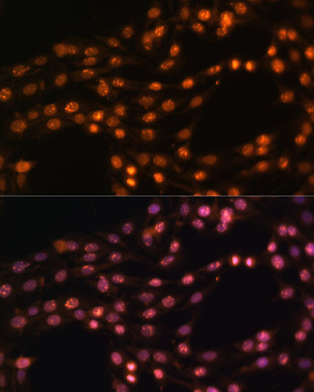 SUZ12 Antibody in Immunocytochemistry (ICC/IF)