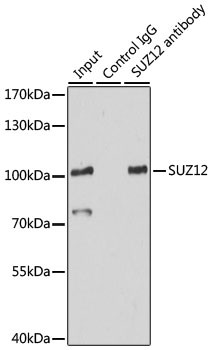 SUZ12 Antibody in Immunoprecipitation (IP)