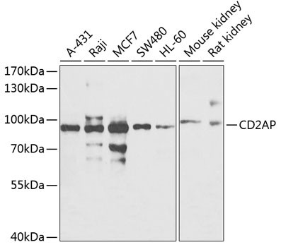 CD2AP Antibody in Western Blot (WB)