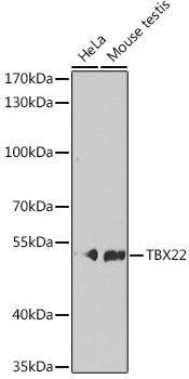 TBX22 Antibody in Western Blot (WB)