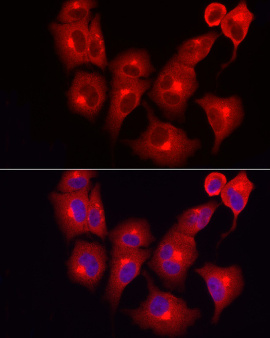 SKIP Antibody in Immunocytochemistry (ICC/IF)