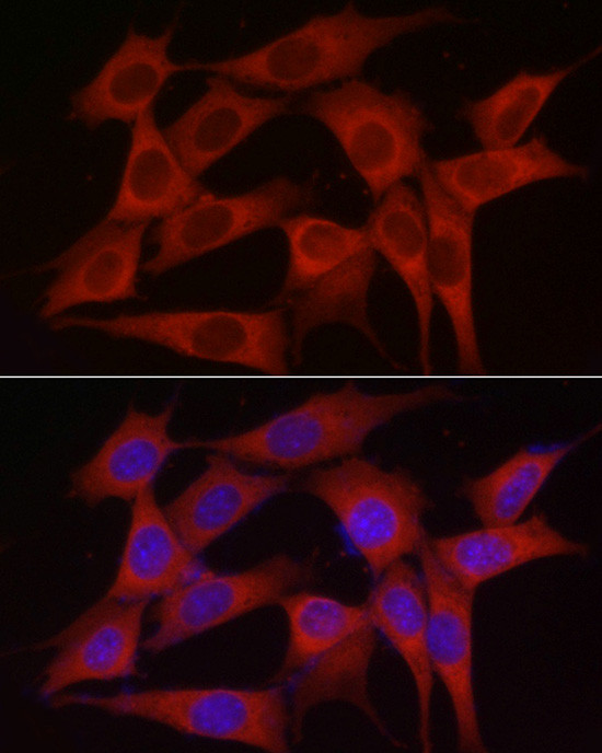 SKIP Antibody in Immunocytochemistry (ICC/IF)