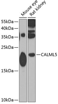 CALML5 Antibody in Western Blot (WB)