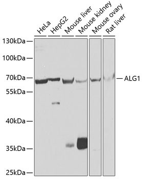 ALG1 Antibody in Western Blot (WB)