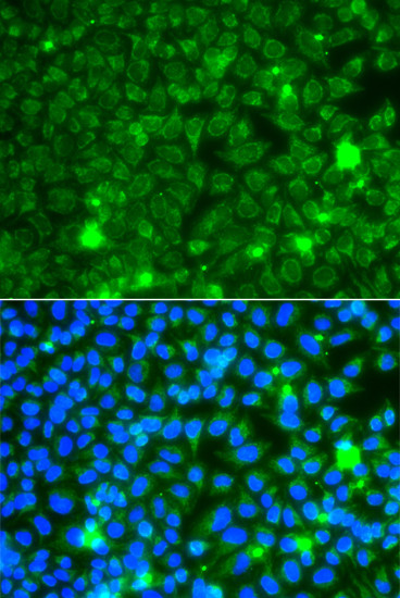 GBA3 Antibody in Immunocytochemistry (ICC/IF)