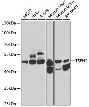 TSEN2 Antibody in Western Blot (WB)