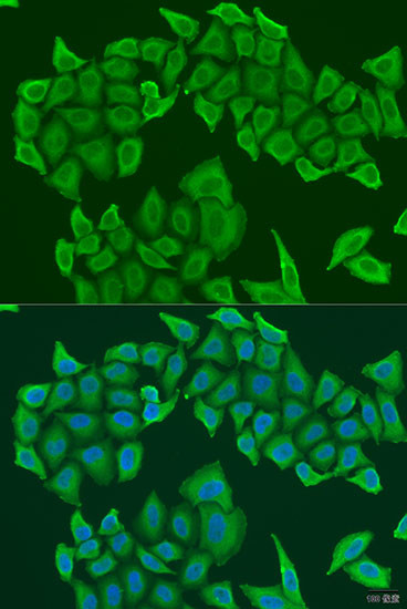 HICE1 Antibody in Immunocytochemistry (ICC/IF)