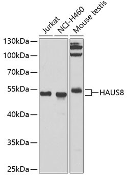 HICE1 Antibody in Western Blot (WB)