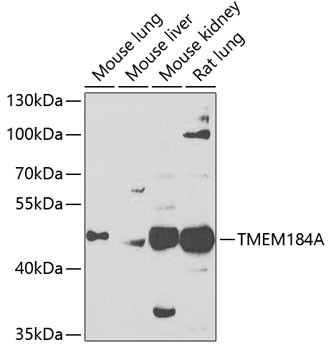 TMEM184A Antibody in Western Blot (WB)