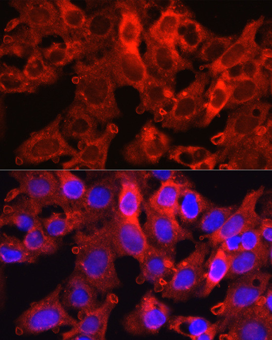 PCSK9 Antibody in Immunocytochemistry (ICC/IF)