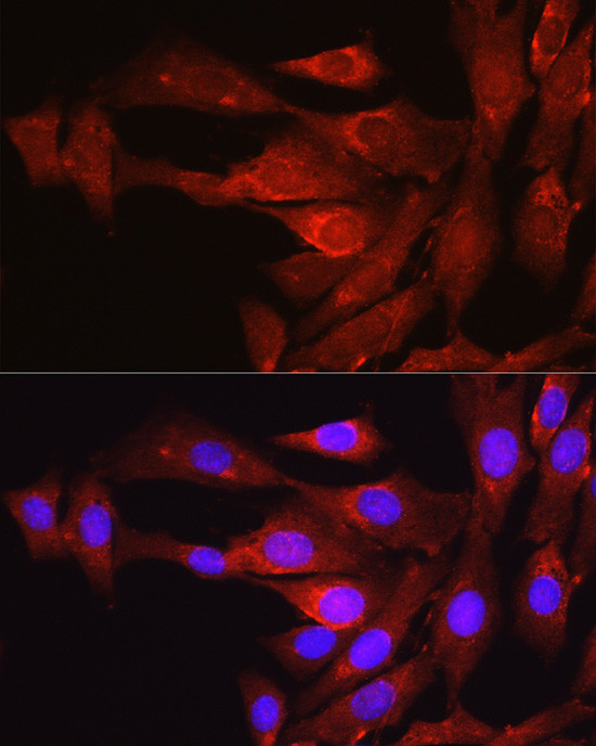 PCSK9 Antibody in Immunocytochemistry (ICC/IF)